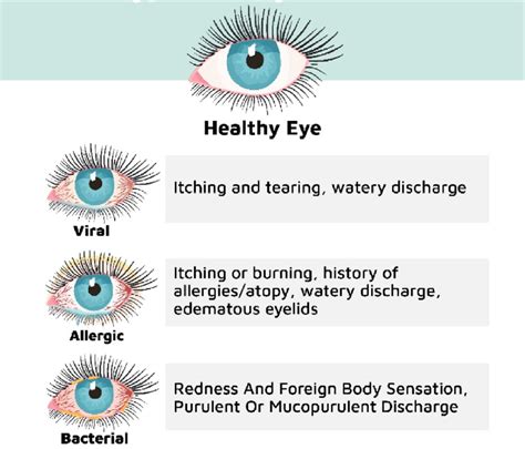 Major Types of Conjunctivitis and their Clinical Manifestations ...