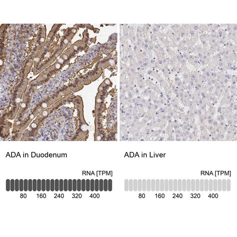 Adenosine Deaminase Antibody (PA5-54912)