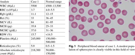 Reticulocyte Count Normal Range