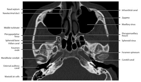 Cross-Sectional Computed Tomography and Magnetic Resonance Imaging ...