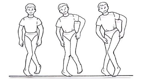 Scissor Gait: Causes, Symptoms, and Treatment