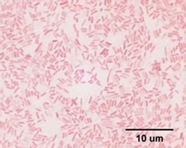 Enterobacter Aerogenes Gram Stain