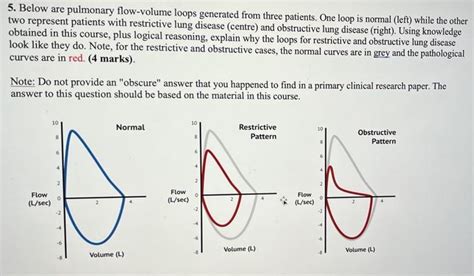 PFT(pulmonary lung function test) 관련 내용 정리 : 네이버 블로그