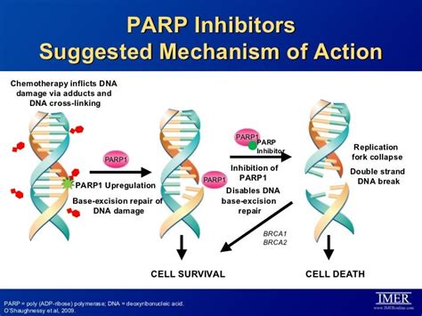 Transforming Treatment in Ovarian Cancer