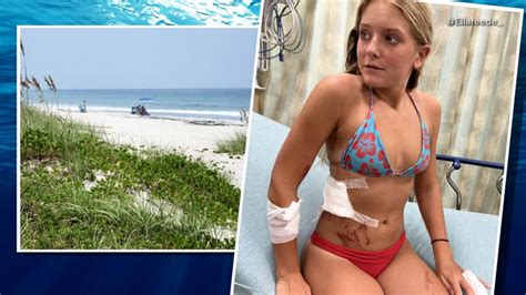 13-year-old recounts fighting off shark attack - Good Morning America