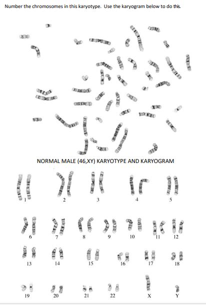 Solved Number the chromosomes in this karyotype. Use the | Chegg.com