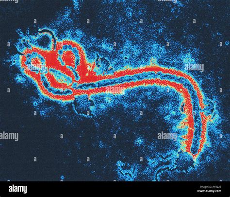 Scanning electron microscope SEM image of the Ebola virus Stock Photo ...