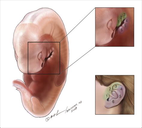 The Histologic Relationship of Preauricular Sinuses to Auricular Cartilage | Orthopedics | JAMA ...