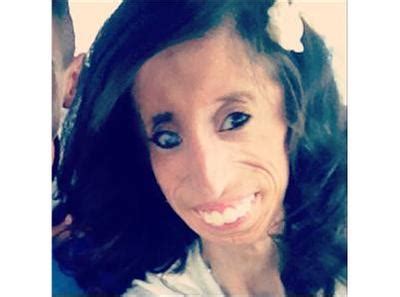 Lizzie Velasquez - Most Beautiful Girl in the World 02/28 by The PM ...