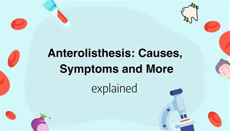 Anterolisthesis: Causes, Symptoms and More