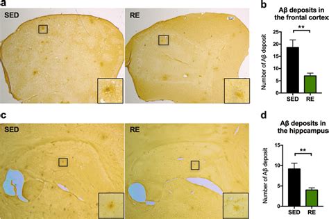 Immunochemical staining of amyloid plaques. a, c Representative images... | Download Scientific ...