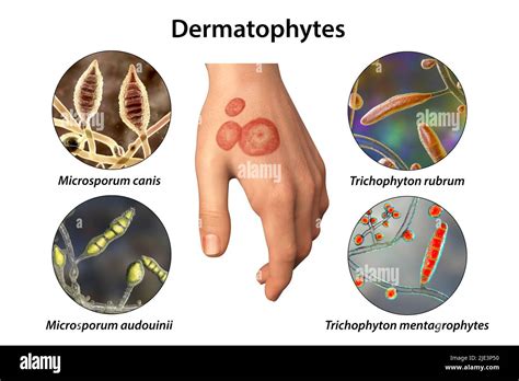 Microsporum canis Cut Out Stock Images & Pictures - Alamy