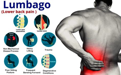 Lumbar Spine Pain | protect.Lumbaforte | Pushpanjali medi India Pvt Ltd