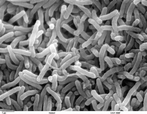 Scientific Image - Cholera Bacteria | NISE Network