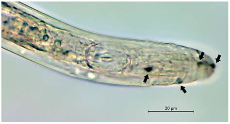 Cephalic region of Bursaphelenchus xylophilus, with spores of Esteya... | Download Scientific ...