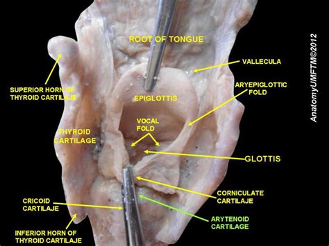 Anatomy, Head and Neck: Larynx Arytenoid Cartilage - StatPearls - NCBI Bookshelf