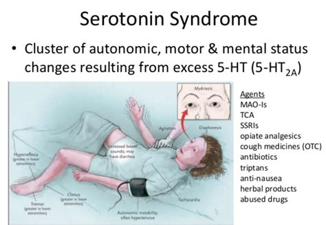 Serotonin Syndrome - Causes, Signs, Symptoms, Duration, Treatment