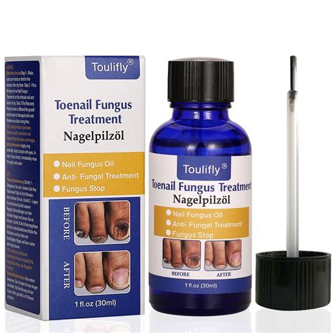 Amazon.com : Nail Fungus Treatment, Fungus Stop, Nail Antifungal Treatment, Anti-Fungal Solution ...