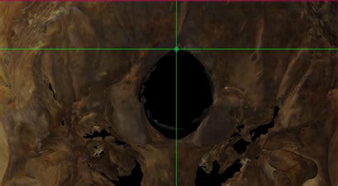 Medial Craneometric Landmarks | Manual 3D Docs