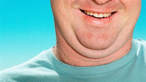 Double Chin Eliminator Injection: What to Know - ABC News