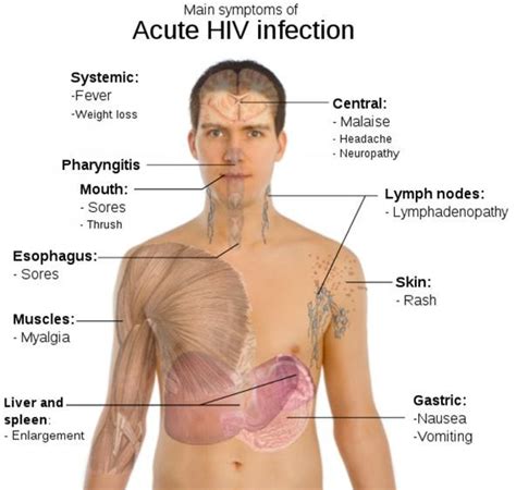 HIV / AIDS, Symptoms and Transmission Method | World Wide Web