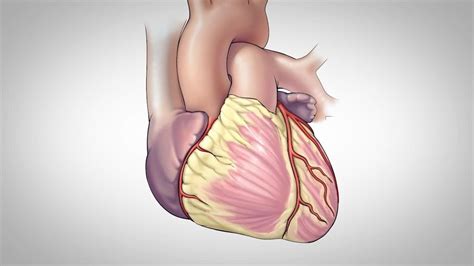 Coronary Artery Bypass Surgery - YouTube