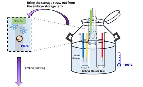 Frozen-thawed Embryo transfer (FET)