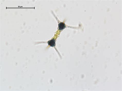 Can anyone help me identify this species of Staurastrum? | ResearchGate