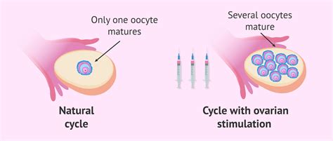 Natural vs. stimulated oocyte maturation