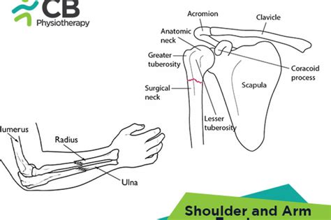 top-5-exercises-for-shoulder-and-arm-fractures.webp