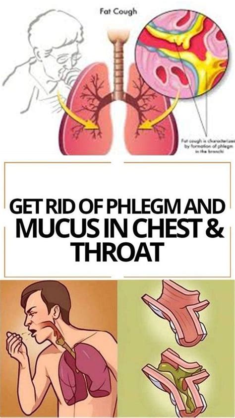 7 Natural Remedies to Flush Mucus From Your Body | Getting rid of phlegm, Chest congestion ...