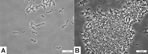 A: Microscopic picture of Bifidobacterium RBL67 grown on MRS-C agar... | Download Scientific Diagram