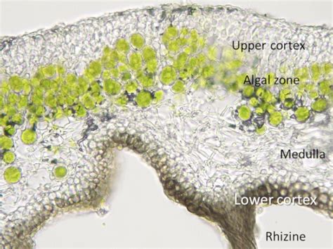 Foliose Lichen Under Microscope