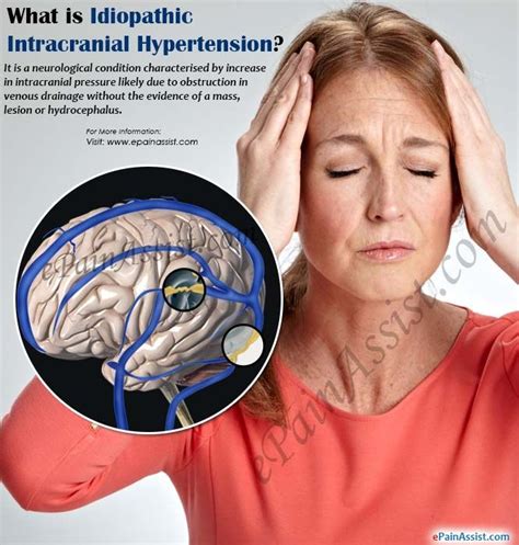 Idiopathic Intracranial Hypertension