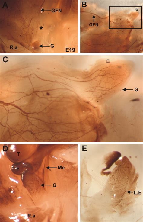 Development of the Gubernaculum During Testicular Descent in the Rat - Nation - 2011 - The ...