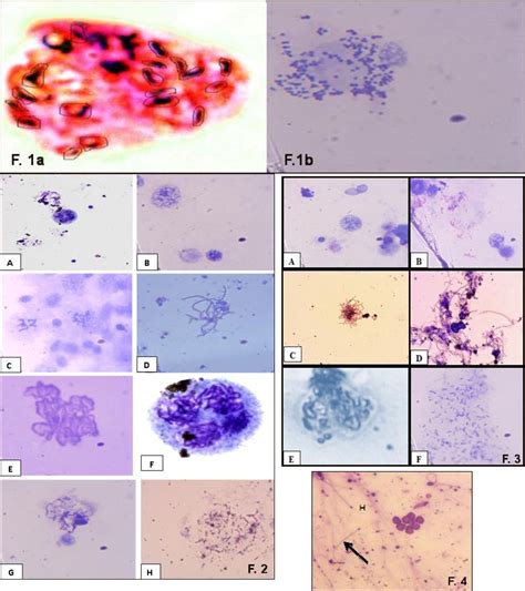 Figure 4 from THE INTERMEDIATE HOST OF SCHISTOSOMA MANSONI | Semantic ...