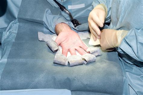 Exploratory hand surgery - Stock Image - C002/6902 - Science Photo Library