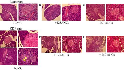 The Effects Of Lean - Lean Choices