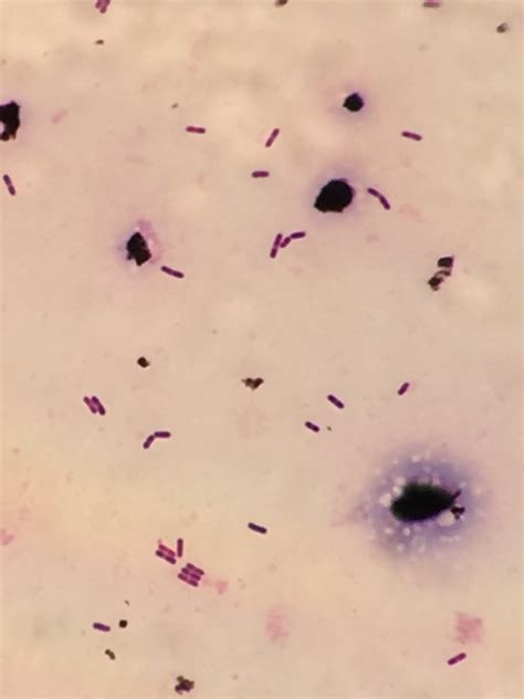 Listeria monocytogenes〔リステリア〕 | グラム染色: Gram Stain