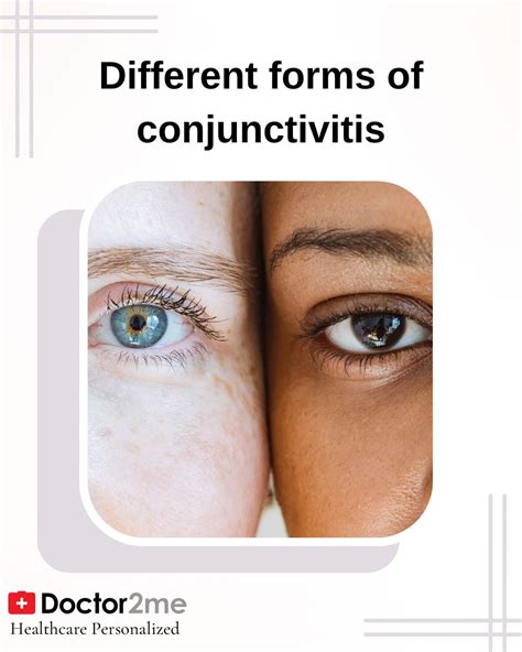 Different forms of conjunctivitis - treatment- prevention-symptoms-healthcare — Doctor2me