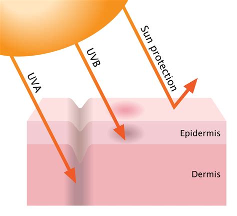 How Sunburns Can Damage Your Skin - Fullerton, CA