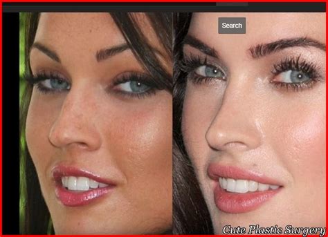 Megan Fox Plastic Surgery Pictures Revealed - Celebrities Plastic Surgery