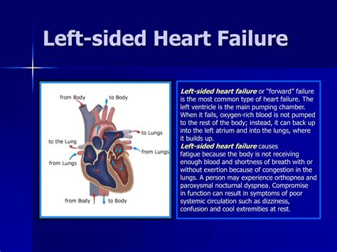 Causes Of Left Sided Heart Failure