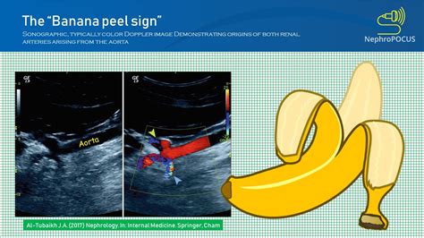 banana-peel – NephroPOCUS