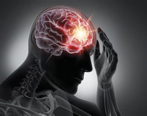 Neuroprotection for stroke: renewed hope for success - Medical Forum