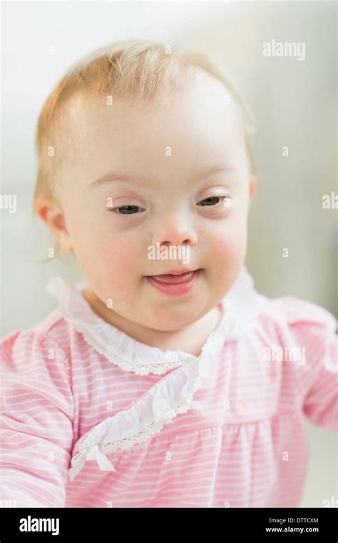 Baby girl down syndrome hi-res stock photography and images - Alamy