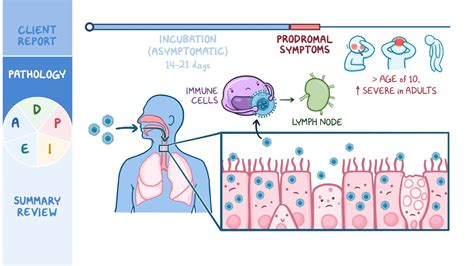 Chickenpox (Varicella): Nursing process (ADPIE) - Osmosis Video Library