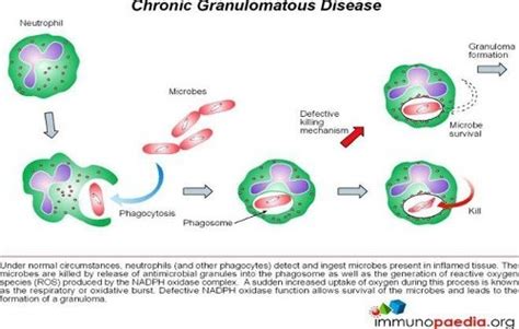 Granulomatous Disease, Chronic