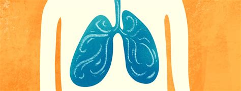 Pulmonx Zephyr Endobronchial Valve Procedure For COPD