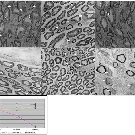 Distribution density of Schwann cells observed under electron... | Download Scientific Diagram